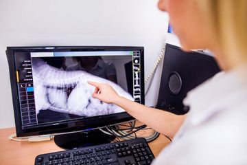 Radiología digital